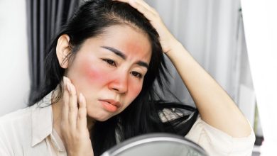 درمان درد و التهاب آفتاب سوختگی با داروی خانگی